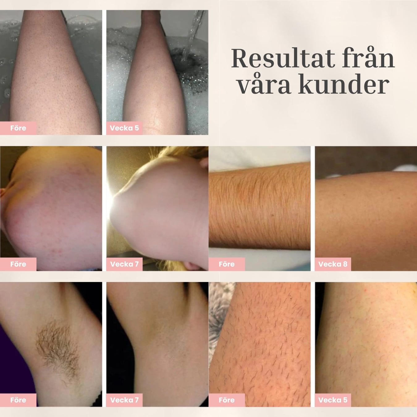 Luvièn IPL Laser - Permanent laserhårfjerning